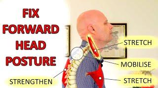 How To Fix Forward Head Posture & Neck Pain