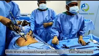 Laparoscopic Cholecystectomy – Removal of the gallbladder - Dr G Rajasekhar Reddy