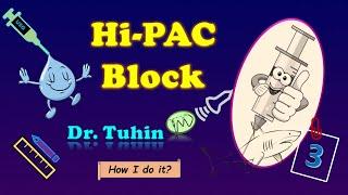 Hi-PAC Block | High-Volume Proximal Adductor Canal Block | Ultrasound | Saphenous | Sciatic