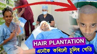 This is Hair Plantation  | সকলো কথা এটা ভিডিওত | First in Assam | Hair Transplant in Assam