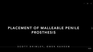 Surgical video malleable penile implant subcoronal approach