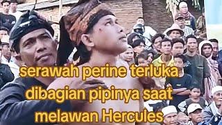 peresean serawah perine terluka di bagian pipinya saat menghadapi Hercules, peresean dusun kambeng