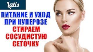 ПИТАНИЕ И УХОД ПРИ КУПЕРОЗЕ - СТИРАЕМ СОСУДИСТУЮ СЕТОЧКУ