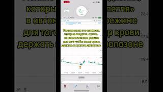 Пример работы «петли» на айфоне #диабет #діабет #diabetes #diabetikdima