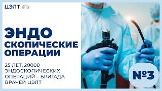 Эндоскопические операции. 25 лет, 20000 эндоскопических операций – бригада врачей ЦЭЛТ