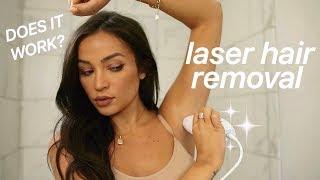 AT HOME LASER HAIR REMOVAL: MY EXPERIENCE!  FAQ + DEMO