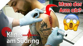 Amputation?  Bodybuilder bangt wegen eitriger Wunde um seinen Arm  | Klinik am Südring | SAT.1