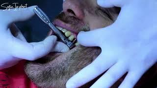 Dental Implant placement