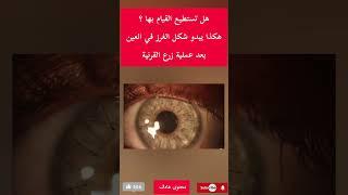 هل تستطيع القيام بهذه العملية؟ #shortvideo #ترند #youtube#اكسبلور #صحة #طب #shorts #short #ytshorts