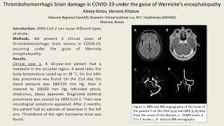 Thrombohemorrhagic brain damage in COVID 19 under the guise of Wernicke's encephalopathy