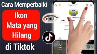 Cara Memperbaiki Opsi Tampilan Profil Tiktok Tidak Ditampilkan | Eye Icon Missing On TikTok Profile