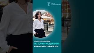 История исцеления. Кристина Буланова. Псориаз и состояние волос.