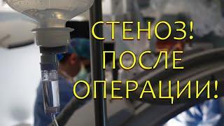 Чего ожидать после операции? Послеоперационный период после операции на стеноз поясничной части.