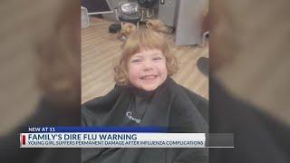 Chillicothe family's living nightmare as girl, 4, falls into coma due to flu