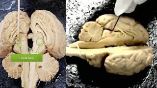 anatomy of the sheep brain video for anatomy class - practice for the practical exam