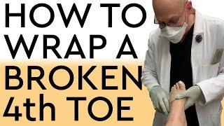 How To Wrap A Broken 4th Toe