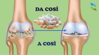 Addio ARTROSI o problemi alla CARTILAGINE con questi 4 integratori naturali!