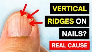 That's The REAL Cause of VERTICAL RIDGES On Your Nails