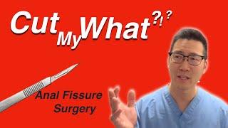 Lateral Internal Sphincterotomy (LIS) | Anal fissure surgery