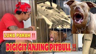 DIGIGIT ANJING PITBULL GALAK ‼️ 30 JAHITAN