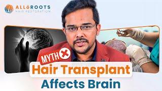 Myths & Facts | Does Hair Transplant Really Affects Brain or Memory? | @alloroots