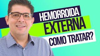 Hemorroida externa, como tratar | Dr Juliano Teles