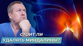 Нужно ли удалять аденоиды и миндалины? Простое лечение воспаления гланд