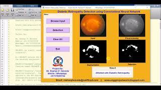 Diabetic Retinopathy Classification Using CNN | Matlab Project With Source Code