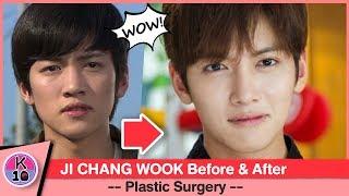  Ji Chang Wook Before and After Plastic Surgery [NETIZEN BUZZ]