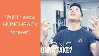 How long does it take to fix hunchback posture?