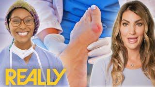 "Horror Movie" Bunion Shocks Dr Ebonie | My Feet Are Killing Me