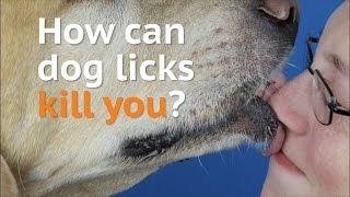 How can dog licks kill you?