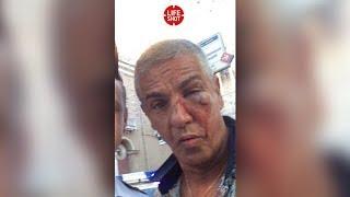 Сам виноват подозреваемый рассказал об избиении звезды Такси Сами Насери