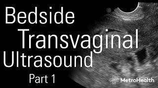 Bedside Transvaginal Ultrasound, Part 1