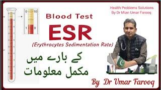 HPS38 |what is ESR test| خون کے ٹیسٹ ای ایس آر کے بارے میں مکمل معلومات |by @drumarfarooq