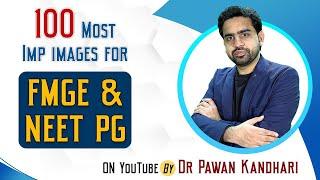 100 Most Important Images (Part-1) For FMGE & NEET PG By Dr. Pawan Kandhari