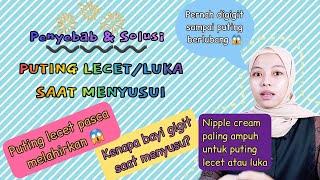 Puting Lecet & Luka Saat Menyusui | Puting Lecet Pasca Melahirkan | Bayi Gigit Saat Menyusu