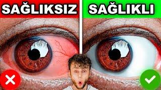 EVDE YAPABİLECEĞİNİZ 10 SAĞLIK TESTİ! (Akciğer Kapasitesi, Sivilcelerin Anlamları, Renk Körlüğü)