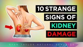 10 STRANGE Signs Your Kidneys Need Help