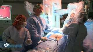 Robot-Assisted Single-Site Gallbladder Removal (Full-Length Surgery)