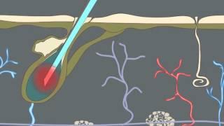 How Electrolysis Works (Animation)