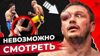 ТОП 10 Самых СТРАШНЫХ травм в ММА!