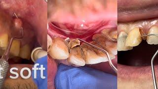 TikTok Compilation Dental Videos