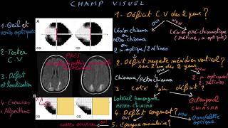 Champ visuel - Docteur Synapse