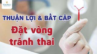 Ưu và nhược điểm khi đặt vòng tránh thai