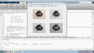 IEEE MATLAB BIOMEDICAL