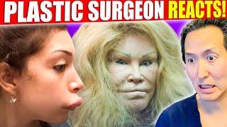 The WORST Celebrity Surgery DISASTERS!