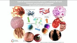 Воспалительные заболевания кишечника в рамках генетических вариантов.