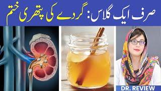 Gurde Ki Pathri Ka Ilaj - Natural Way To Get Rid Of Kidney Stones | Home Remedies