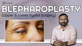 Cosmetic Effects of Aging or Eyelids | Upper and Lower Eyelid Surgery (Blepharoplasty)